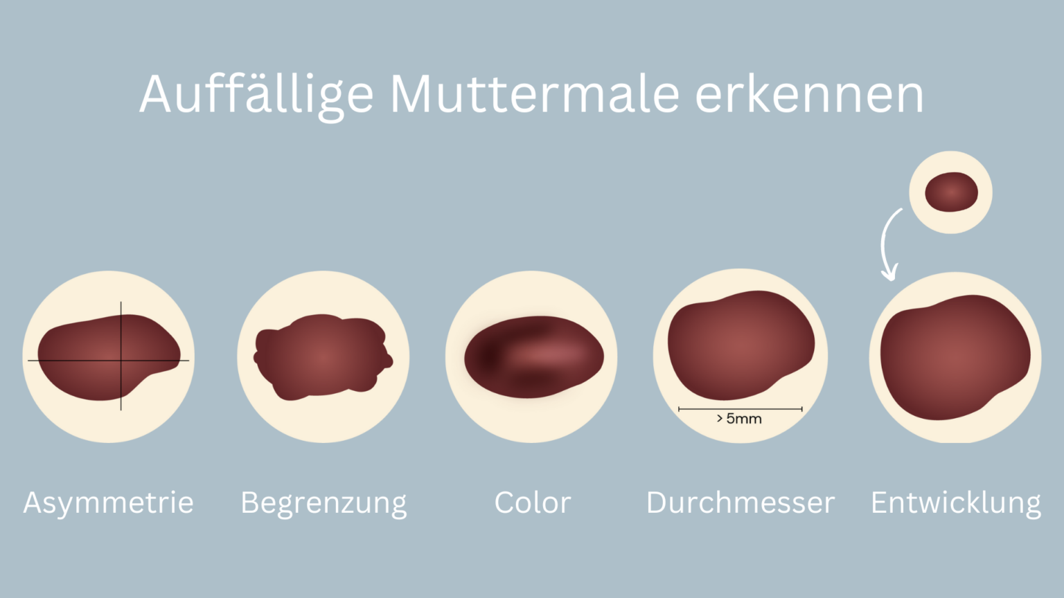 ABCDE-Regel: Hautkrebs Erkennen | Sanaskin